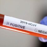 تست تشخیص کووید 19