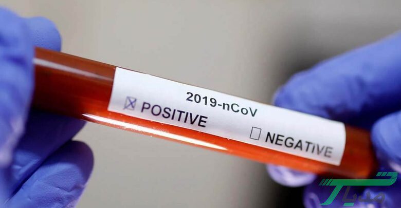 تست تشخیص کووید 19