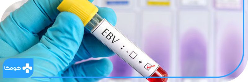 هرپس چیست + تشخیص ویروس تبخال 14 images 1658916429