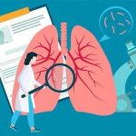 تاثیر عوامل ژنتیکی بر خطر سرطان ریه سیگاری ها