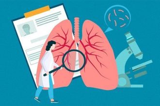 تاثیر عوامل ژنتیکی بر خطر سرطان ریه سیگاری ها