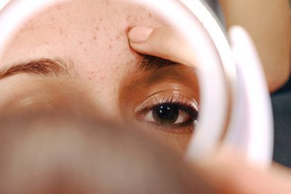 باکتری آکنه و کمک به محافظت از پوست 13 باکتری آکنه و کمک به محافظت از پوست