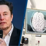 بینایی مجدد با تراشه Blindsight ایلان ماسک