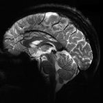 قدرتمندترین دستگاه MRI جهان اولین اسکن مغزی خیره‌کننده را ثبت کرد